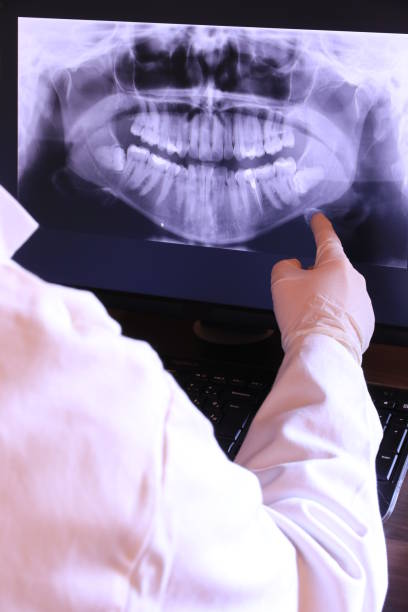 Best Emergency Gum Treatment in Kettering, MD