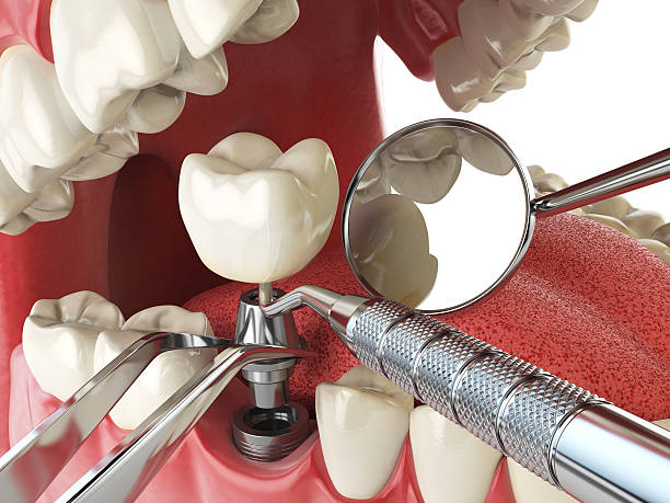 Best Emergency Denture Repair in Kettering, MD